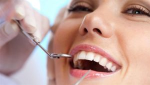 denti perfetti 300x171